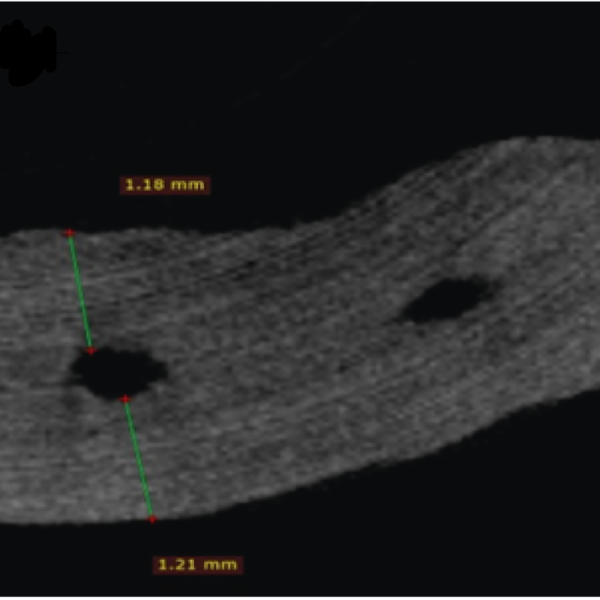 Comparison of Canal Transportation and Centering Ability of One-G, EdgeGlidePath, and Neolix: a Micro Computed Tomography Study of Curved Root Canals